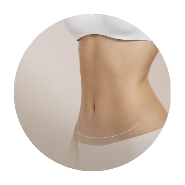 Procedimento Abdominoplastia